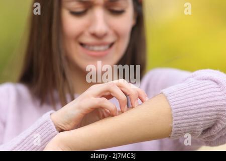 Vista frontale da vicino di un teen stressato grattando braccio itchy in un parco Foto Stock