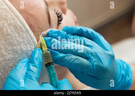 Siringa con plasma sanguigno di un paziente in una mano di un cosmetologo per un plasmolifting della pelle del viso di una donna. Plasma terapia, il ripristino delle cellule della pelle Foto Stock