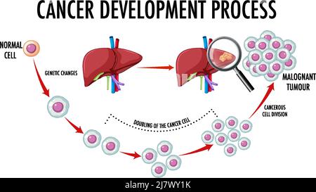 Diagramma che mostra l'illustrazione del processo di sviluppo del cancro Illustrazione Vettoriale