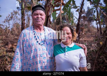 Ritratto di un padre africano e di una figlia che soffrono di albinismo, persone con poca melanina nella loro pelle Foto Stock