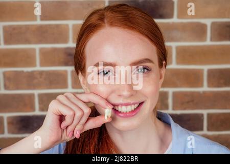 femmina di zenzero rosso con sorriso bianco-neve che tiene il dente bianco della saggezza dopo l'intervento chirurgico rimozione di un dente Foto Stock