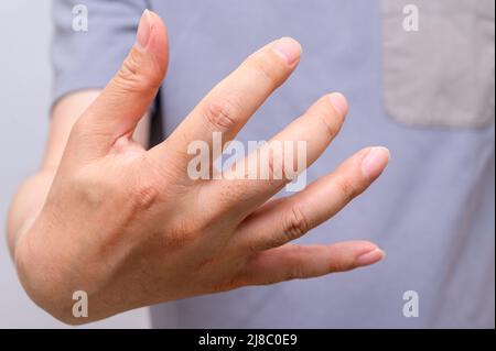 Mani di uomini che soffrono di dolore alle articolazioni delle dita. Cause di artrite reumatoide, gotta. Assistenza sanitaria e concetto medico. Foto Stock