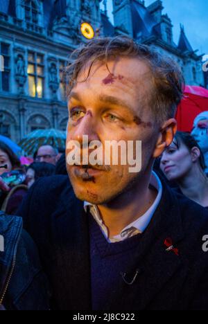 Parigi, Francia, Ritratto vittima di un attacco omofobico a Paris Street, Wilfred de Brujn, violenza contro gli omosessuali Foto Stock