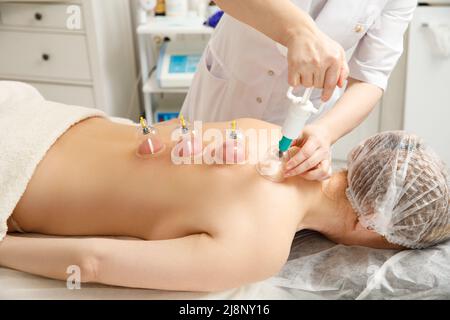 Massaggio sottovuoto. Coppe del vuoto di terapia medica di cupping sulla schiena della donna, primo piano, medicina cinese. Foto Stock