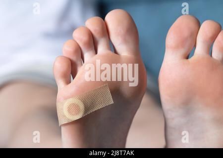 Piede donna con cerotto medico incollato per verruca plantare. Trattamento di calli e verruche sui piedi, dermatologico Foto Stock