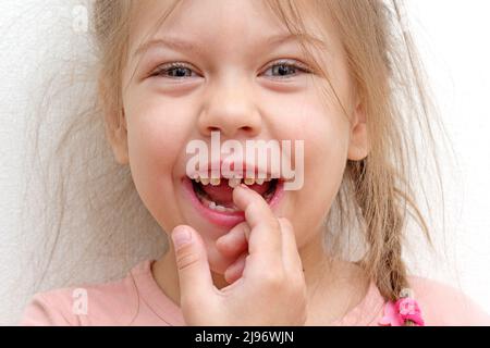 Felice e sorridente caucasica bambina di 5-6 anni toccando dente sciolto con il dito guardando la fotocamera Foto Stock