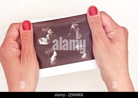 Vista dall'alto delle mani della donna tagliate che tengono l'ecografia prima immagine del trimester del bambino su sfondo bianco Foto Stock