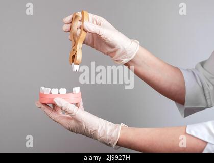 Le mani del dentista tirano il dente con le pinze fuori dal modello della mandibola. Rimozione dei denti, odontoiatria concetto. Trattamento delle malattie dentali. Foto di alta qualità Foto Stock