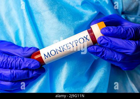 Nuovo campione infettivo della malattia del virus Monkeypox in provetta da laboratorio nella mano dello scienziato in guanto medico blu su sfondo chiaro. Foto Stock