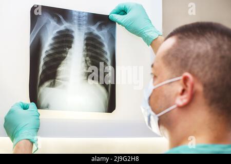 Mano dell'uomo che tiene una radiografia dei polmoni isolata su uno sfondo bianco. Medico che indossa maschera e guanti che guardano la radiografia del torace Foto Stock
