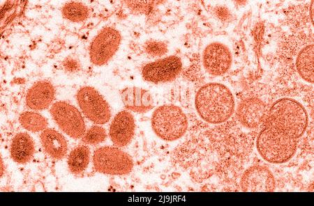 VIRUS MONKEYPOX. Questa immagine microscopica elettronica (EM) raffigura un virione scimmipox, ottenuto da un campione clinico associato con l'epidemia di cane prateria 2003. Era un'immagine di sezione sottile da un campione di pelle umana. A sinistra erano particelle virali mature di forma ovale, e a destra erano i mezzentri, e le particelle sferiche di virioni immaturi. Foto Stock