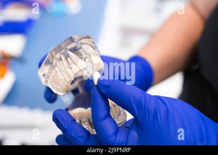 Dentista che tiene una mandibola artificiale inferiore. Protesi dentaria. Piastra dentaria. Lavori di protesi Foto Stock