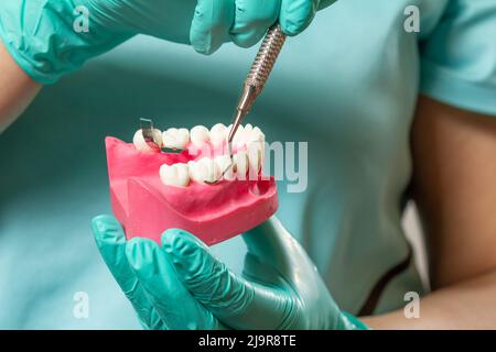 Mani del dentista con disposizione della mandibola umana e dello strumento dentale. Foto Stock