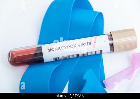 Provetta per campioni di sangue per il test del virus Monkeypox. Foto Stock