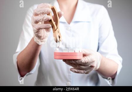 Dentista che tira il dente con le pinze fuori dal modello della mandibola. Estrazione dei denti causata da trauma, decadimento, malattia dentale. Stomatologia, concetto di assistenza sanitaria. Foto di alta qualità Foto Stock