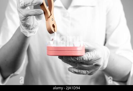 Dentista che tira il dente con le pinze fuori dal modello della mandibola. Estrazione dei denti, allentamento, concetto di stomatologia. Lavoro del chirurgo dentario in camice da laboratorio e guanti. Foto di alta qualità Foto Stock