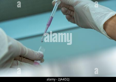 Le mani di un ricercatore scienziato che lavora in guanti con una pipetta e una fiala con cellule. Dettaglio di una caduta Foto Stock