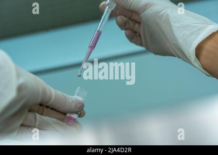 Le mani di un ricercatore scienziato che lavora in guanti con una pipetta e una fiala con cellule. Dettaglio di una caduta Foto Stock