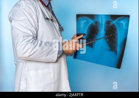 Medico irriconoscibile che indica una radiografia dei polmoni umani Foto Stock