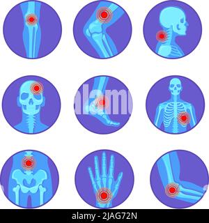 Malattie delle articolazioni ortopediche. Dolore reumatoide osso ginocchio mano gomito artrite, reumatologia scheletro corpo medicina chirurgia piede cranio pelvi cartoon illustrazione vettoriale. Artrite e malattia ortopedica Illustrazione Vettoriale