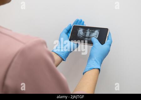 dispositivo di presa con touch screen, risultati dell'esame radiologico della bocca di una persona, esame per il trattamento dentale, tecnologia e dispositivo in studio Foto Stock