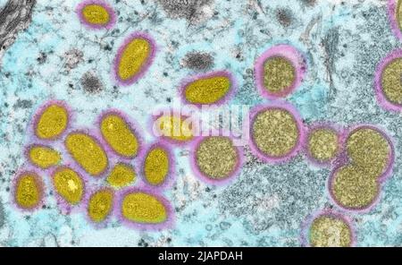 Questa immagine microscopica elettronica (EM) raffigura un virione scimmipox, ottenuto da un campione clinico associato con l'epidemia di cane prateria 2003. Era un'immagine di sezione sottile da un campione di pelle umana. A sinistra erano particelle virali mature di forma ovale, e a destra erano i mezzentri, e le particelle sferiche di virioni immaturi. Una versione ottimizzata e migliorata di un'immagine prodotta dai Centri statunitensi per il controllo e la prevenzione delle malattie / credito CDC /C.S. Oreficeria; R.Regnery 2003. Falsa resa dei colori Foto Stock