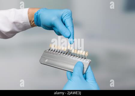 primo piano della mano del dentista che presenta la guida dell'ombra per controllare l'impiallacciatura dei denti Foto Stock