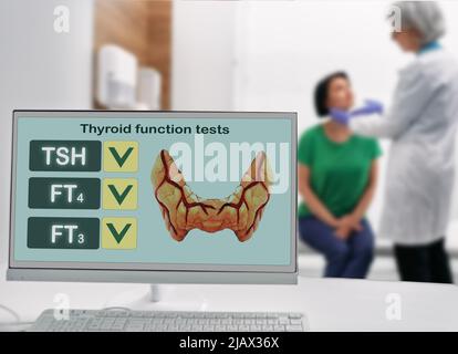 Monitor con illustrazione della tiroide sul tavolo del medico, da dietro l'endocrinologo controllo della tiroide in paziente femminile. Test di funzionalità tiroidea, Foto Stock