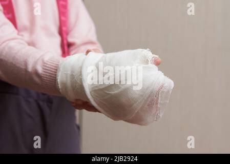 Mano dei bambini in un primo piano di gesso medico Foto Stock