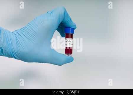 indossare guanti blu tenendo una provetta per analisi del sangue davanti a una sala di laboratorio Foto Stock