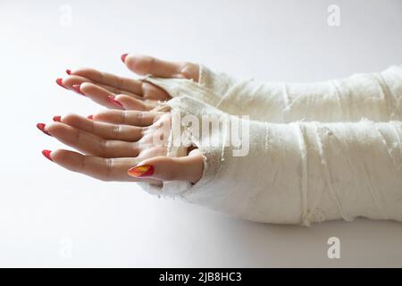 due mani femmine con polsi rotti dopo essere caduto da una bicicletta in un cast su uno sfondo isolato, mani in un cast Foto Stock