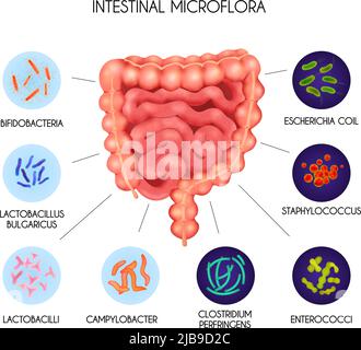 Infografica realistica degli organi interni umani della microflora intestinale dei batteri con la spirale di Escherichia staphylococcus enterococchi clostridium perfringens la Illustrazione Vettoriale