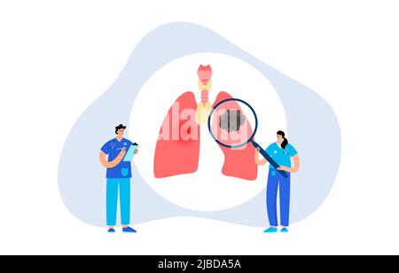 Cancro ai polmoni, illustrazione Foto Stock