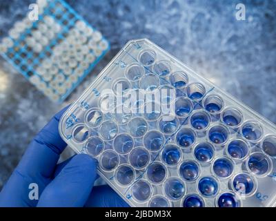 Primo piano di uno scienziato che detiene una compressa microbiologica con anticorpi in laboratorio, un esperimento con anticorpi umani. Foto Stock