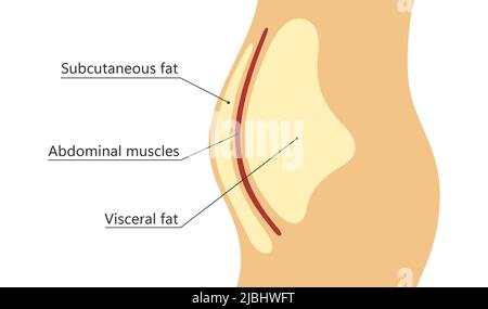 Grasso viscerale e sottocutaneo intorno alla linea della vita. Posizione del grasso viscerale nella cavità addominale. Tipi di obesità umana. Schema medico. Vettore Illustrazione Vettoriale