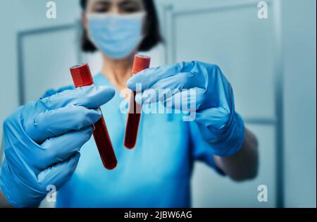 Provette per campioni di sangue con virus Monkeypox infetto da sangue in mani di un assistente di laboratorio, primo piano Foto Stock