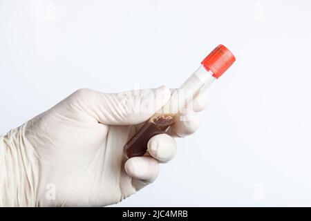 primo piano delle mani che maneggiano una sonda del sangue per l'analisi in laboratorio Foto Stock