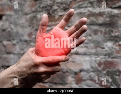 Aspetto palmo doloroso del vecchio asiatico. Concetto di sindrome compartimentale, cellulite e dolore ai muscoli delle mani. Foto Stock