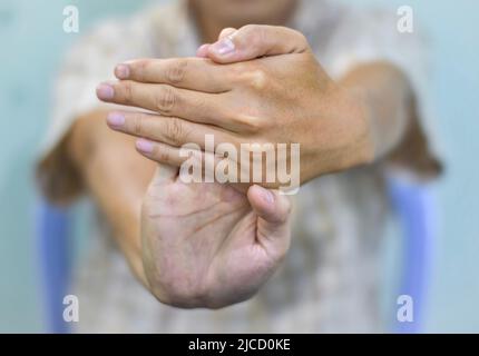 Rafforzamento dell'esercizio per i muscoli del braccio di giovane paziente asiatico con spasmo muscolare. Foto Stock