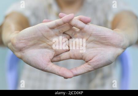 Rafforzamento dell'esercizio per i muscoli del braccio di giovane paziente asiatico con spasmo muscolare. Foto Stock