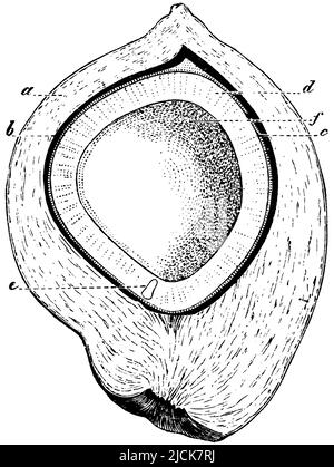 Palma di cocco(a) epicarpium, (b) endocarpium, (c) seme di palma, (d) seme di albume, (e) germe, f) cavità nell'albume di semi contenente il latte, Cocos nucifera, anonym (botany book, 1875), Kokospalme, Der Länge nach durchschnitten. A) Epicarpium, b) Endocarpium, c) Samenschale, d) Sameneiweiß, e) Keim, f) Höhle im Sameneiweiß, welche die Milch enthält, Cocotiera) épicarpe, b) endocarpe, c) tégument, d) albume, e) germe, f) cavité dans l'albumen contenant le lait. Foto Stock