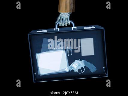 X-Ray di uomo d'affari e Gun in Briefcase Foto Stock