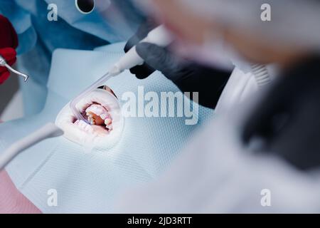 Il processo di pulizia della saliva nell'ufficio dentale. Procedure dentistiche. Foto di alta qualità Foto Stock