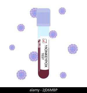 Una provetta con il sangue di una persona con scimmietta. Test positivo per il virus. Illustrazione vettoriale. Illustrazione Vettoriale