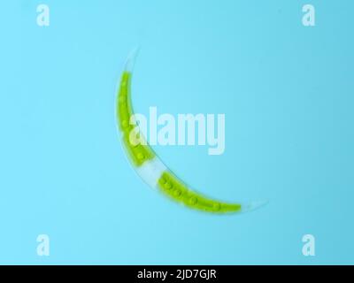 Closterium desmid alga al microscopio Foto Stock