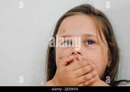 ritratto di piccola ragazza triste livida con capelli lunghi e scuri che ricoprono la bocca con la mano. Protesta contro gli abusi. Foto Stock