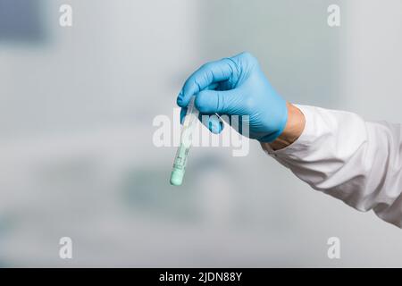 Mano del medico con una provetta per il campione di feci per lo screening del cancro del colon Foto Stock