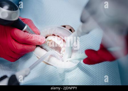 Primo piano delle mani dei dentisti nel processo di spazzolatura dei denti della paziente femminile. Foto di alta qualità Foto Stock