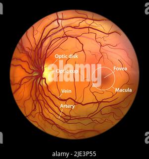 Retina normale, immagine oftalmoscopica, illustrazione. La retina è la membrana sensibile alla luce che allinea la parte posteriore dell'occhio. Vasi sanguigni (rossi) radi Foto Stock