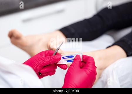 I chiropodisti sconfezionano una lama per bisturi dalla confezione sterile Foto Stock